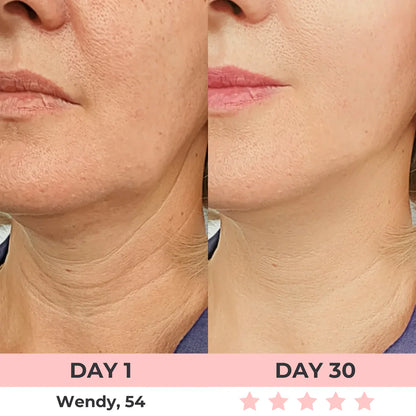 DERMALifter (Copy) before reza